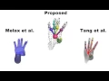Hand Pose Estimation Guided Combined Optimisation