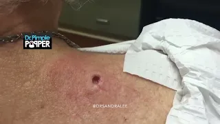 The Most Astounding DPOW Extractions Ever Recorded!