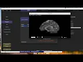 UMass Amherst CONN Workshop Part 3 Preprocessing