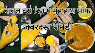 बी हैरान हो जाएंगे 10 दिन के अंदर आपका हाथ मुंह साफ आप खुद यकीन नहीं कर पाएंगे केवल 10 दिनों में