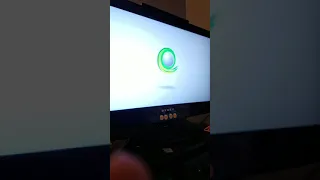 My PS1 Has A Xbox Virus 