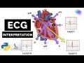Detection of Cardiovascular Disease Using ECG Images in Machine Learning and Deep Learning FLASK
