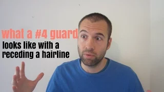 What a Guard Buzz Cut Looks Like with a Receding Hairline