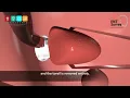 Do you know the difference between Intracapsular vs Extracapsular tonsil surgery