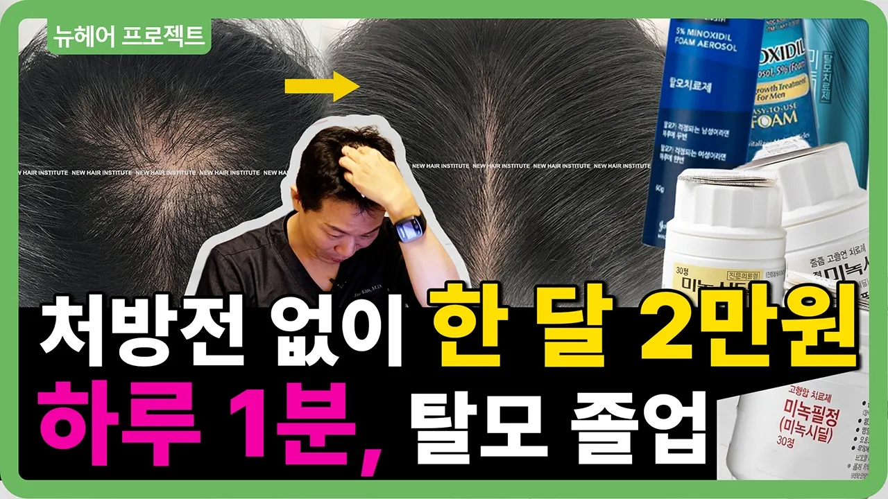 탈모 영양제 1년치 살 돈 아끼세요! '미녹시딜' 한 달 2만 원으로 끝내는 의사의 특급 처방