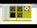 Brain Tumor Detection Using Image Processing Matlab Project Code Brain Tumor Classification