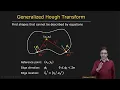 Generalized Hough Transform Boundary Detection