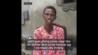 Interview with Bbc pidgin on my Scleroderma journey