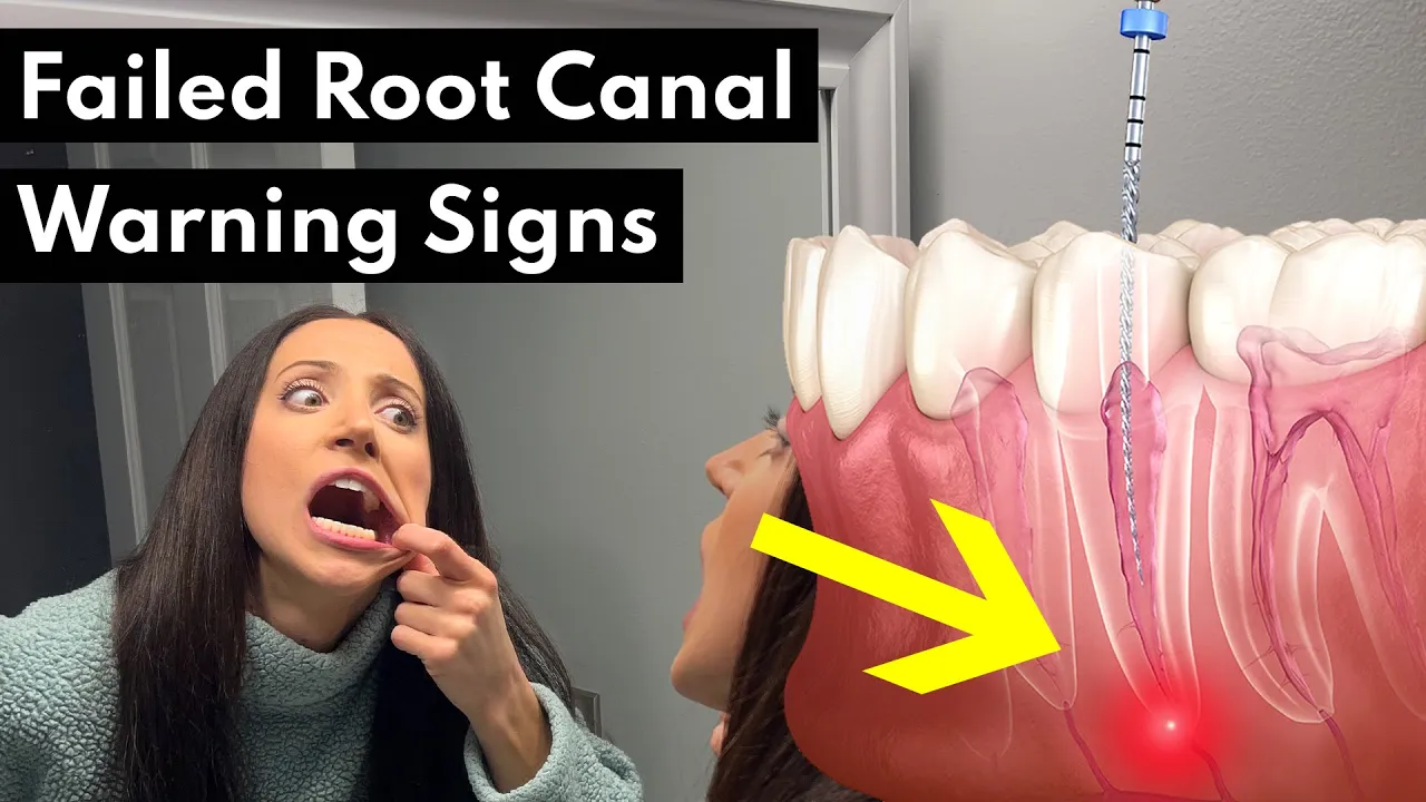 Outline Video 7 Warning Signs Your Root Canal FAILED