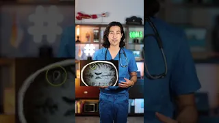 What can you do about TAPEWORMS