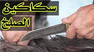                                            دندنها