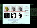 Citrus Leaf Disease Detection Using Image Processing With Source Code Python OpenCV Project