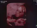 16 week baby boy ultrasound 3D ultrasound and first glimpse ultrasound