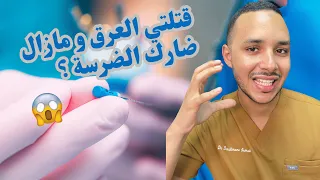 قتلتي العرق و مازال ضارك الضرسة واش عادي أو لا 