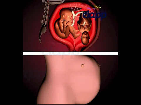 Amazing Twin Pregnancy Animation, Twin Fighting Inside the Womb 😲 |