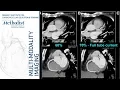 Lagu Cardiac CT: Current Technology \u0026 Principles (Faisal Nabi, MD, FACC) September 11, 2018