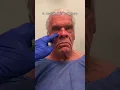 Major Male Facelift Transformation Watch until the end
