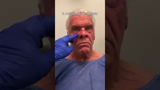 Major Male Facelift Transformation Watch until the end