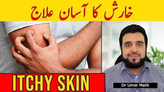 itchy skin kharish ka ilaj kharish khatam karne ka tarika khujli ka ilaaj khaarish ka elaj