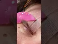 Download Lagu De Koreaanse Lash Lift Shields van het volgende niveau zijn HIER!