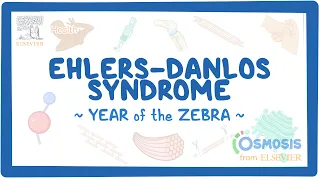 Ehlers-Danlos syndrome (Year of the Zebra)