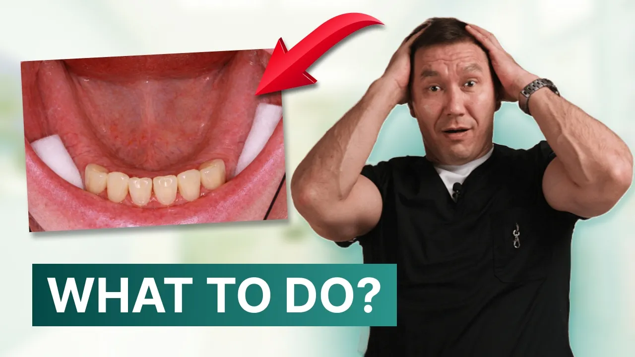Only Front Teeth Left — What to Do?: video thumbnail