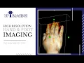 Hand Rendering Medical Diagnostic Imaging UP Imaging Center Spartanburg SC