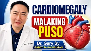 Cardiomegaly: Enlarged Heart - Dr. Gary Sy