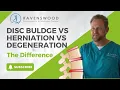 Disc Buldge vs Herniation vs Degeneration