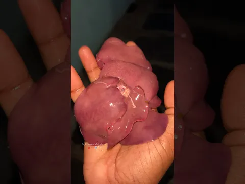 కోడి గుండెకాయల అట్టు ఏందిరా 🙄