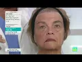 Dr Sevinor Skincare Solutions PREMIERE June 10 2021 5pm