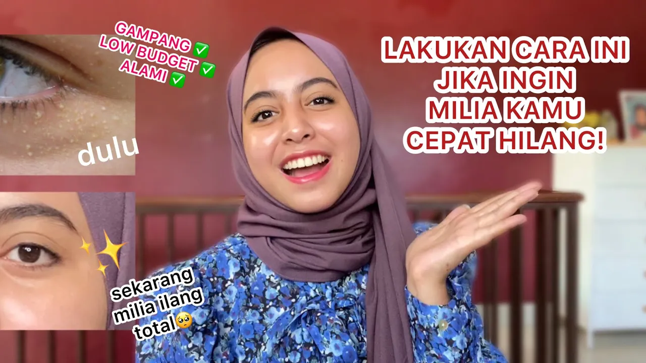 Cara Menghilangkan Milia (Jerawat Batu) & Mencerahkan Kantung Mata | Avoskin Intensive Eye Cream. 