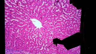 Histologia do Fígado    Lâmina
