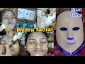 TRIED Hydrafacial first time Hydra facial Before After Result my experience