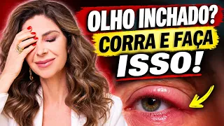 ACORDOU COM O OLHO INCHADO? PODE SER NORMAL — OU UM SINAL DE ALERTA (Saiba Diferenciar)