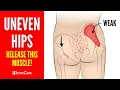 Lagu #1 Muscle to Release to Fix Your Pelvic Tilt (Uneven Hips)