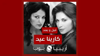 قبل و بعد  كارينا عيد دندنها