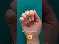 Lagu How to whiten your nails #shorts