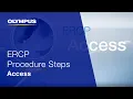 ERCP Procedure Steps I Access
