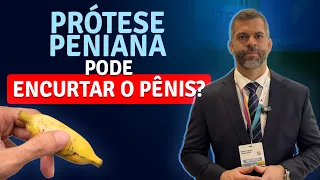 Prótese peniana pode encurtar o pênis? | Dr. Marco Túlio Cavalcanti (CRM: 136030 – RQE: 56669)