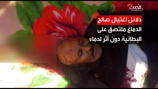 طبيب شرعي شاهد فيديو صالح ماذا كشف 