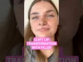 You will not BELIEVE this CLEFT LIP TRANSFORMATION