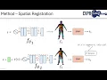 Dynamic Neural Surfaces for Elastic 4D Shape Representation and Analysis