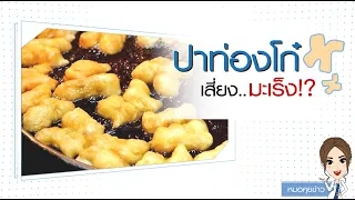 สารอะคริลาไมด์คืออะไร และมันทำให้เกิดมะเร็งได้จริงหรือไม่