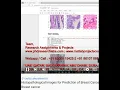 Histopathological Images for Prediction of Breast Cancer Using python code - Breast cancer
