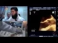 Download Lagu How to perform 3D-TEE exam \