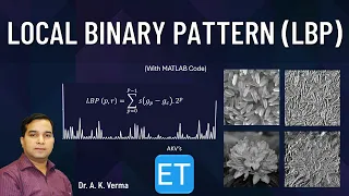 Local Binary Pattern LBP