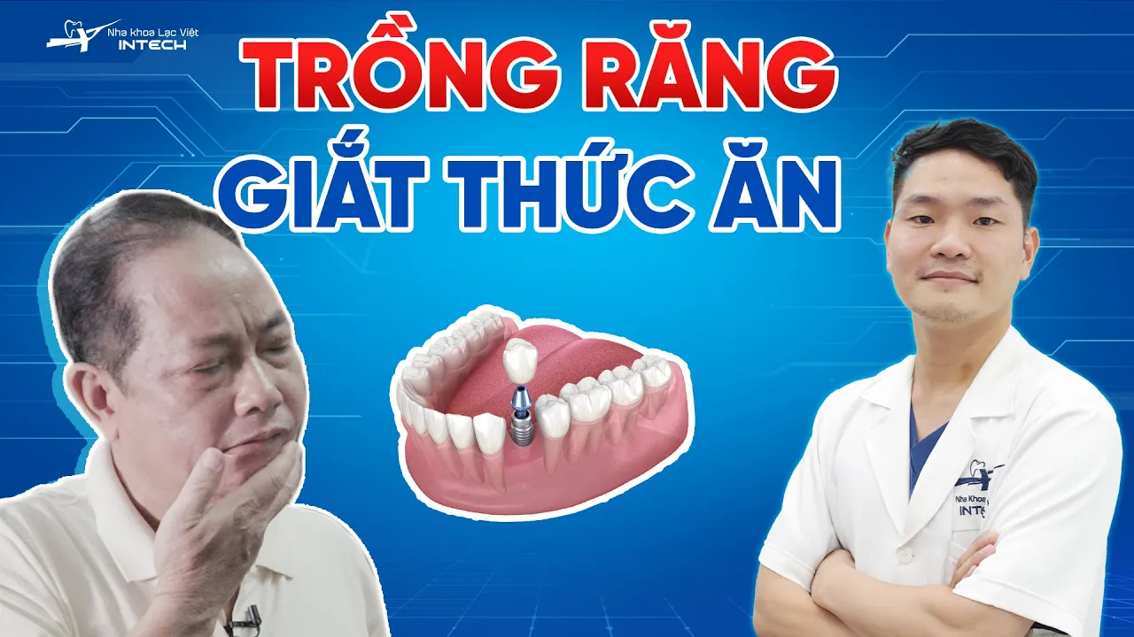 Outline Video Vì Sao Răng Implant Dễ Giắt Thức Ăn I Cải Thiệt Giắt Răng Bằng phục hình DCT