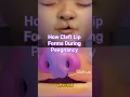 How Does a Cleft Lip Form in Womb Watch This Amazing Animation