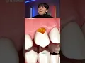 Download Lagu Try Not to Laugh Challenge 1148 🤣 #funny ⁠#shorts #viral